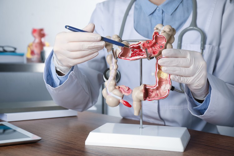 ¿Cuándo consultar a un gastroenterólogo?
